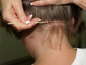 Lice Removal Clinics San Diego California