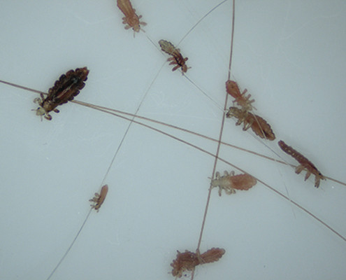 head-lice-removal-san-diego