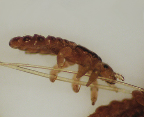 head-lice-removal-san-diego