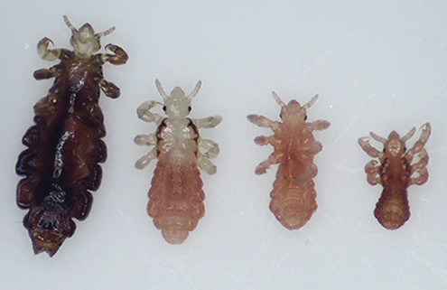 what-do-head-lice-look-like