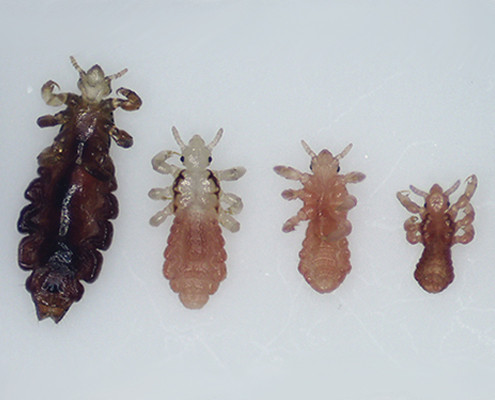what-do-head-lice-look-like
