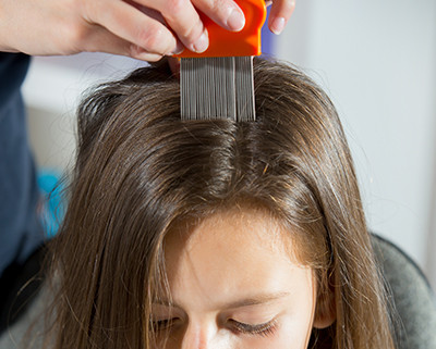 head-lice-treatment-san-diego