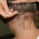 head-lice-removal-san-diego