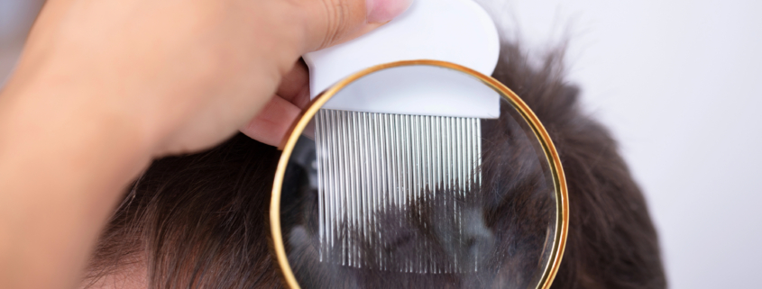 lice treatment san diego